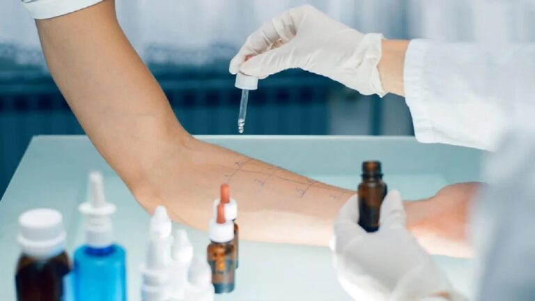 Sağlıklı Yaşamanın Temeli Alerji Testi